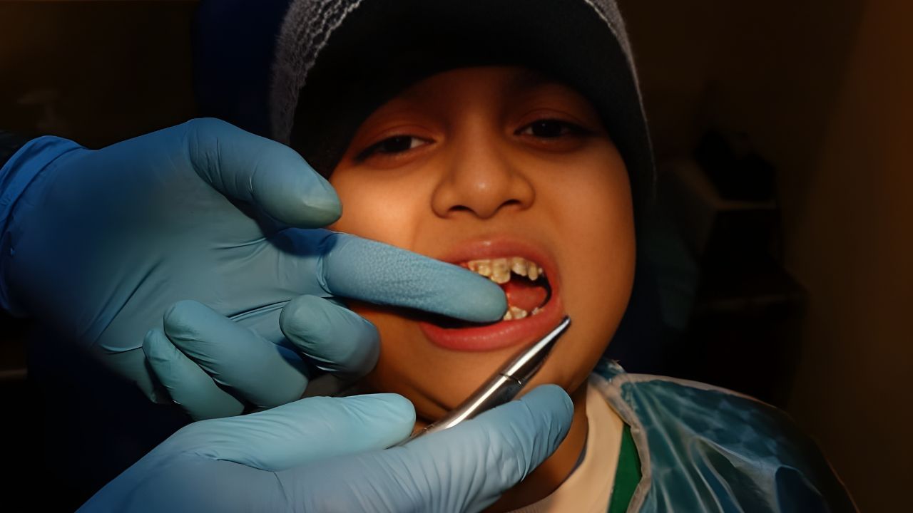 Braces for children Bright Smiles Start Early